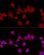 UCHL5 Antibody in Immunocytochemistry (ICC/IF)