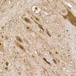 UCHL5 Antibody in Immunohistochemistry (Paraffin) (IHC (P))