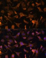 UFC1 Antibody in Immunocytochemistry (ICC/IF)