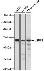 USP12 Antibody in Western Blot (WB)