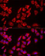 USP21 Antibody in Immunocytochemistry (ICC/IF)