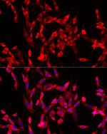 USP21 Antibody in Immunocytochemistry (ICC/IF)