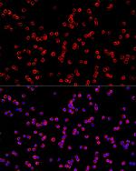 USP21 Antibody in Immunocytochemistry (ICC/IF)