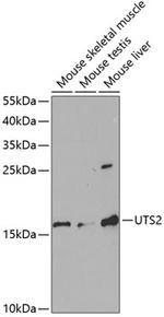 UTS2 Antibody in Western Blot (WB)