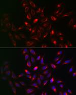 VAPB Antibody in Immunocytochemistry (ICC/IF)