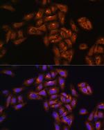 Alix Antibody in Immunocytochemistry (ICC/IF)