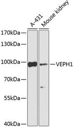 VEPH1 Antibody in Western Blot (WB)