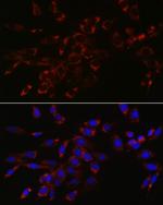 VPS4A Antibody in Immunocytochemistry (ICC/IF)