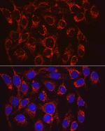 VPS4A Antibody in Immunocytochemistry (ICC/IF)