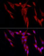 WDR6 Antibody in Immunocytochemistry (ICC/IF)