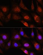 ZC3H12D Antibody in Immunocytochemistry (ICC/IF)