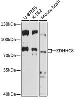 ZDHHC8 Antibody in Western Blot (WB)