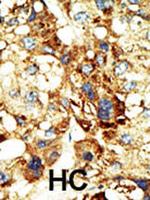 DNMT3A Antibody in Immunohistochemistry (Paraffin) (IHC (P))