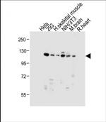 DNMT3A Antibody in Western Blot (WB)