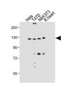 DNMT3A Antibody in Western Blot (WB)