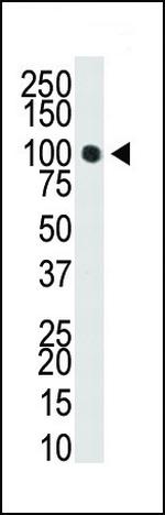 DNMT3A Antibody in Western Blot (WB)