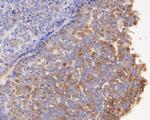 Follicle Stimulating Hormone Antibody in Immunohistochemistry (Paraffin) (IHC (P))