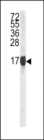 Histone H3 Antibody in Western Blot (WB)