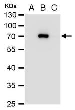 Japanese Encephalitis Virus NS3 Antibody in Western Blot (WB)