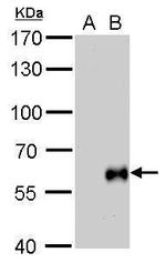 Influenza B HA Antibody in Western Blot (WB)