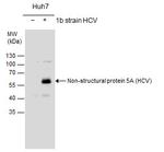 Hepatitis C Virus NS5A Antibody in Western Blot (WB)