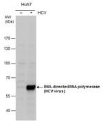 Hepatitis C Virus NS5b Antibody in Western Blot (WB)