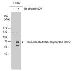 Hepatitis C Virus NS5b Antibody in Western Blot (WB)