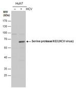 Hepatitis C Virus NS3 Antibody in Western Blot (WB)