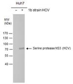 Hepatitis C Virus NS3 Antibody in Western Blot (WB)