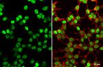 SV40 T-Antigen Antibody in Immunocytochemistry (ICC/IF)