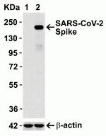 SARS-CoV-2 Spike Protein S1/S2 Antibody in Western Blot (WB)