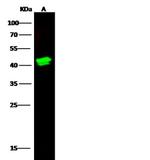 Langerin Antibody in Western Blot (WB)