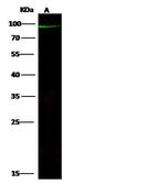 ABCB5 Antibody in Western Blot (WB)