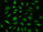 E2F4 Antibody in Immunocytochemistry (ICC/IF)