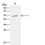 TIPIN Antibody in Immunoprecipitation (IP)