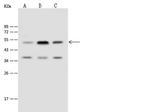 TIPIN Antibody in Western Blot (WB)