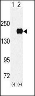 EHMT1 Antibody in Western Blot (WB)