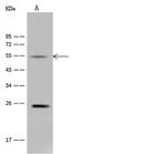 ALDH9A1 Antibody in Western Blot (WB)