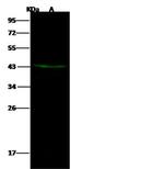 DACH2 Antibody in Western Blot (WB)