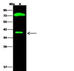 CTBS Antibody in Western Blot (WB)