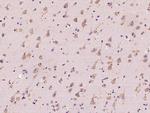 RAB5IF Antibody in Immunohistochemistry (Paraffin) (IHC (P))