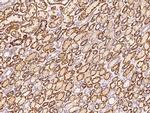 ATP Synthase beta Antibody in Immunohistochemistry (Paraffin) (IHC (P))