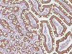 ATP Synthase beta Antibody in Immunohistochemistry (Paraffin) (IHC (P))