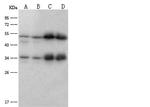 ATP Synthase beta Antibody in Western Blot (WB)