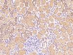 P2Y6 Antibody in Immunohistochemistry (Paraffin) (IHC (P))