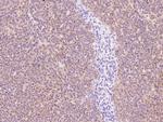 P2Y6 Antibody in Immunohistochemistry (Paraffin) (IHC (P))