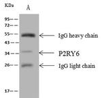 P2Y6 Antibody in Immunoprecipitation (IP)