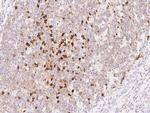 CD38 Antibody in Immunohistochemistry (Paraffin) (IHC (P))