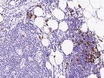 CD38 Antibody in Immunohistochemistry (Paraffin) (IHC (P))