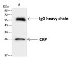 CRP Antibody in Immunoprecipitation (IP)